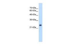 Nicotinamide N-Methyltransferase/NNMT Antibody, Novus Biologicals 0.1mg;